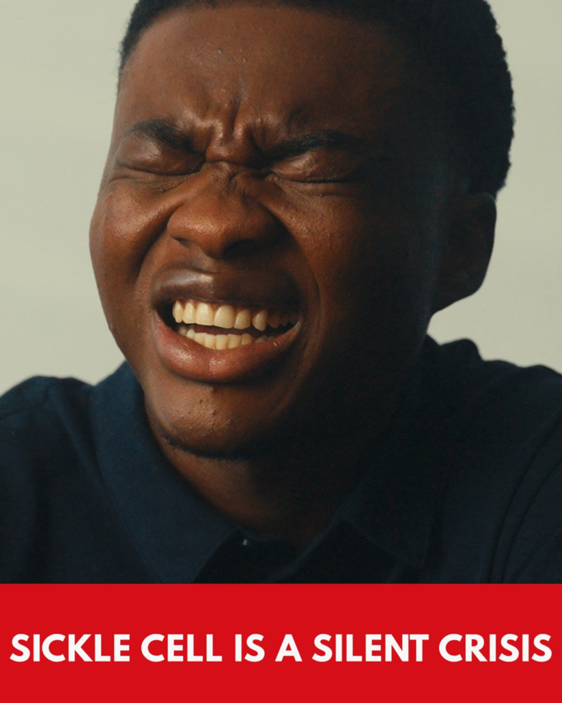 Abraham’s a Sickle Cell warrior screaming